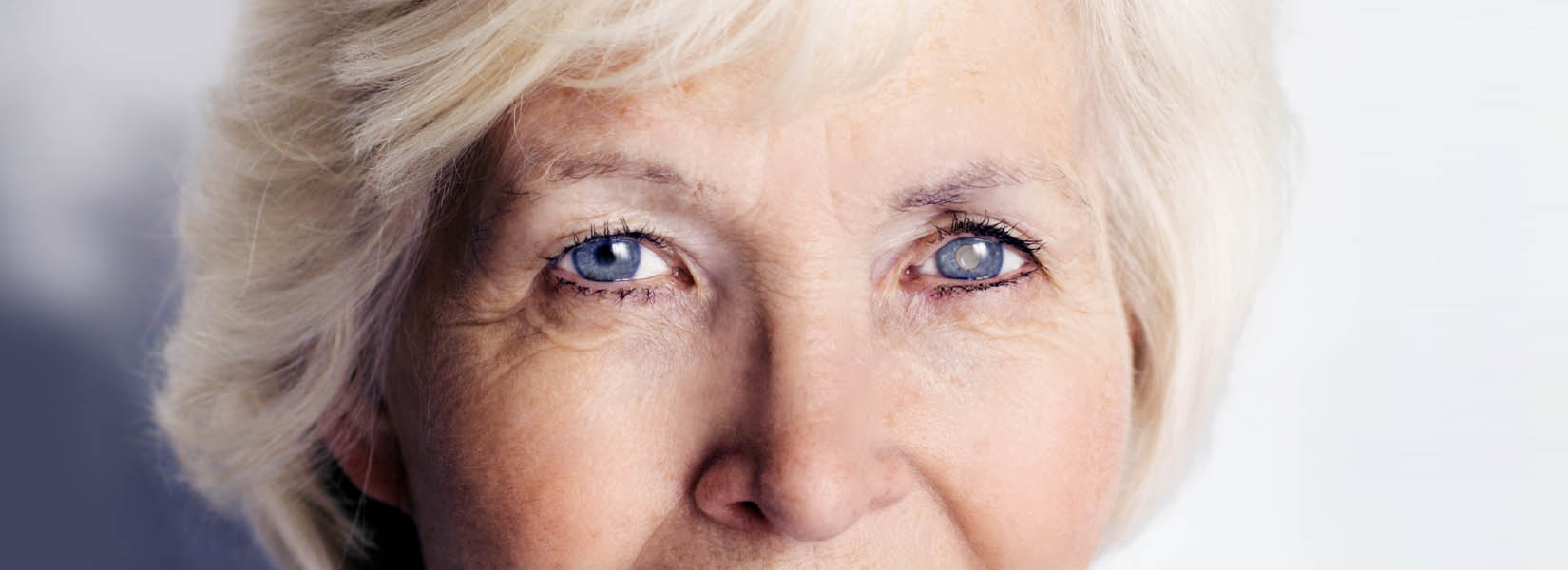 Cataract Surgery in Lake Mary
